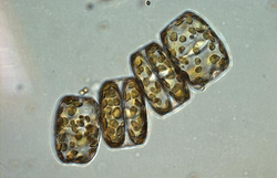 Marine phytoplankton Melosira sp.