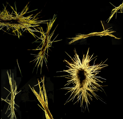 Micrograph collage of Trichodesmium, a photosynthetic bacteria.