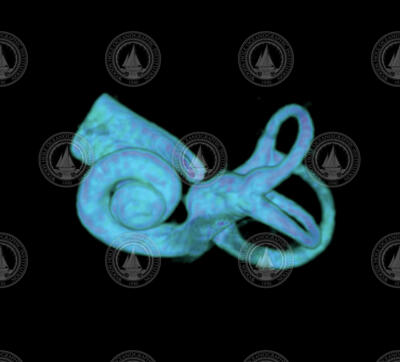 CT scan image of a human cochlea.