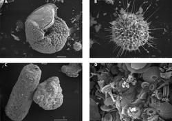 Electron micrographs of components of OFP trap particle flux.