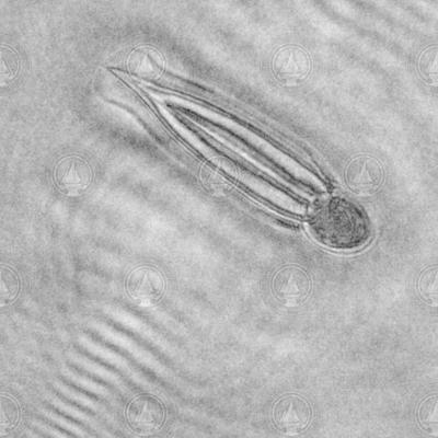 Holocam image of larvacean.