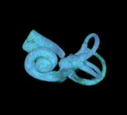 CT scan image of a human cochlea.