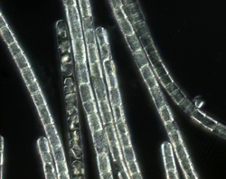 DIC micrograph of a colony of Trichodesmium sp.