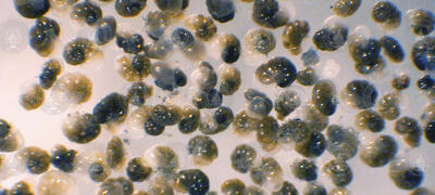 Single-celled eukaryotes known as foraminifera, or forams.