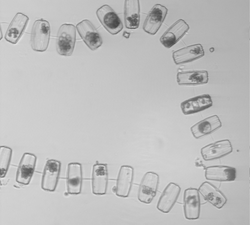 An unhealthy diatom chain.