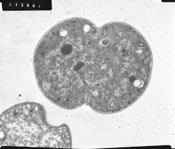 Electron microscopic image of the cyanobacterium, Crocosphaera watsonii.
