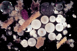 One of the first photographs of sediment trap samples including fecal pellets.