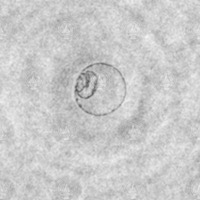 Holocam image of a fish egg.