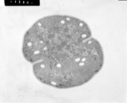 Electron microscopic image of the cyanobacterium, Crocosphaera watsonii.
